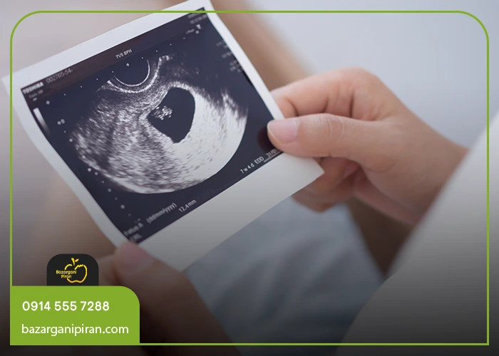 آلبالو و گیلاس؛ پوست شفاف و گلگون جنین